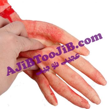 دست بریده خونی