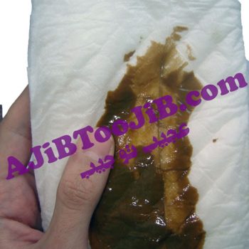 پوشک بچه کثیف